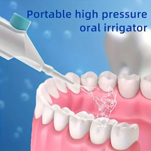 High Pressure Oral Irrigator Portable Teeth Clean - Image 2